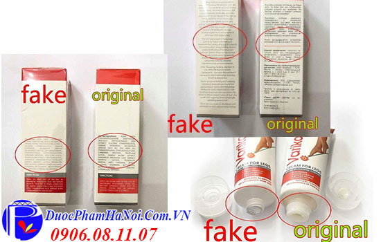 Kem bôi suy giãn tĩnh mạch Varikosette của Nga